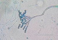 ME008 0357 Scopulariopsis spp..jpg