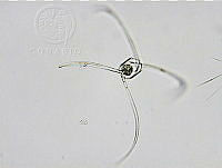 DUHByJSP0004 Chaetoceros coarctatus.png