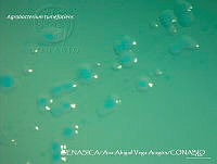 AAVA049 Agrobacterium tumefaciens.jpg