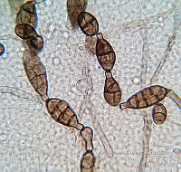 ME008 0027 Alternaria spp..jpg