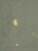 JSP096 Chaetoceros peruvianus.JPG