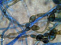 ME008 0025 Alternaria spp..jpg