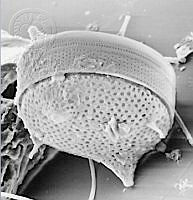 DUHB0057 Cerataulus smithii.png