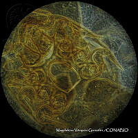 MVG 0652 Uroobovella sp..JPG