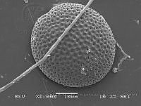 ZME y MEMC-LFMS273 Prorocentrum compressum.JPG