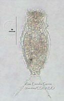 HE009 R 0125 Cephalodella gibba.jpg