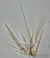 GPHA0139 Porobeltraniella porosa.jpg