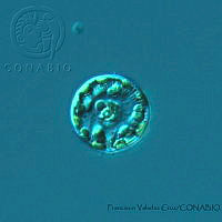 FVC0037 Cyclotella meneghiniana.jpg