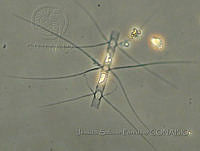 JSP097 Chaetoceros pseudosymmetrycus.JPG