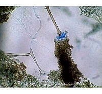 ME008 0038 Aspergillus.jpg
