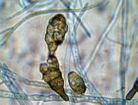 ME008 0015 Alternaria spp..jpg