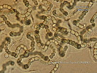 KT016 0031 Nostoc sp..jpg