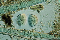 UNAMGAMZ-12 Chroococcus turgidus.jpg