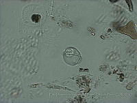 EDISyBDP005 Coolia sp..jpg