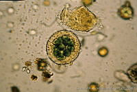 UNAMGAMZ-1 Asterocapsa divina.jpg