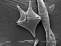 ZME y MEMC-LFMS264 Protoperidinium venustum.JPG