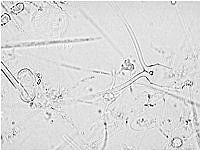 DUHB0093 Chaetoceros peruvianus.JPG