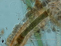 KT016 0051 Xenococcus sp..jpg