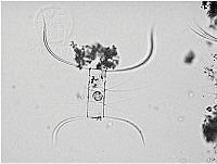 DUHB0090 Chaetoceros didymus.JPG