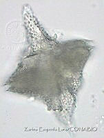 KEL0428 Spiraulax kofoidii.JPG
