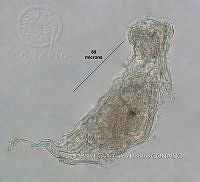 HE009 R 0085 Trichocerca stylata.jpg