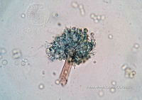 ME008 0066 Aspergillus.jpg