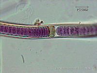 KT018 0034 Brasilonema tolantongensis.jpg