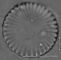 KT018 0077 Cyclotella menenghiniana.jpg