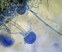 ME008 0049 Aspergillus.jpg