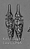 KEL0284 Phalacroma oxytoxoides.JPG