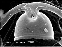 DUHB0097 Chaetoceros peruvianus.png