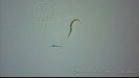 EAMS023 Trichostrongylidae.jpg