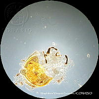 MVG 0651 Uroobovella sp..JPG