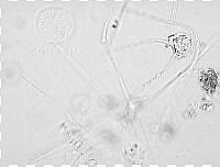 DUHB0094 Chaetoceros peruvianus.png