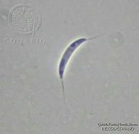 GPHA0052 Dictyochaeta assamica.jpg