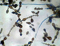 ME008 0018 Alternaria spp..jpg