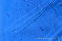 KT018 0226 Pseudanabaena catenata 2.jpg