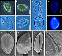 JC006 0013 Ostreopsis ovata.jpg
