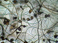 ME008 0022 Alternaria spp..jpg
