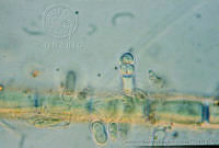 UNAMGAMZ-8 Chamecalyx calyculatus.jpg