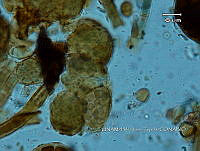 KT016 0002 Asterocapsa sp..jpg