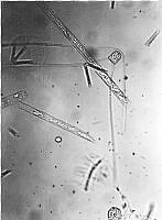 DUHB0095 Chaetoceros peruvianus.png