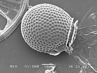 ZME y MEMC-LFMS274 Metaphalacroma skogsbergii.JPG