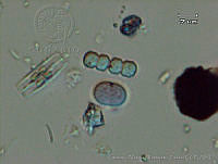 UNAMGAMZ-27 Cyanothece sp..jpg