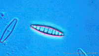 UNAMECU-24 Denticula tenuis.jpg