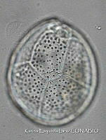 KEL0240 Ostreopsis siamensis.JPG