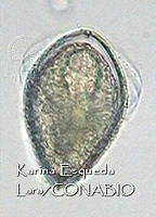 KEL0082 Dinophysis argus.JPG