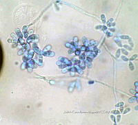 ME008 0397 Ulocladium spp..jpg