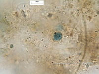 KT016 0018 Dermocarpella sp..jpg