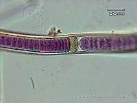 KT018 0034 Brasilonema tolantongensis.jpg
